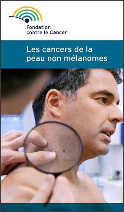m lanome cancer peau brochure fondation ebook Doc